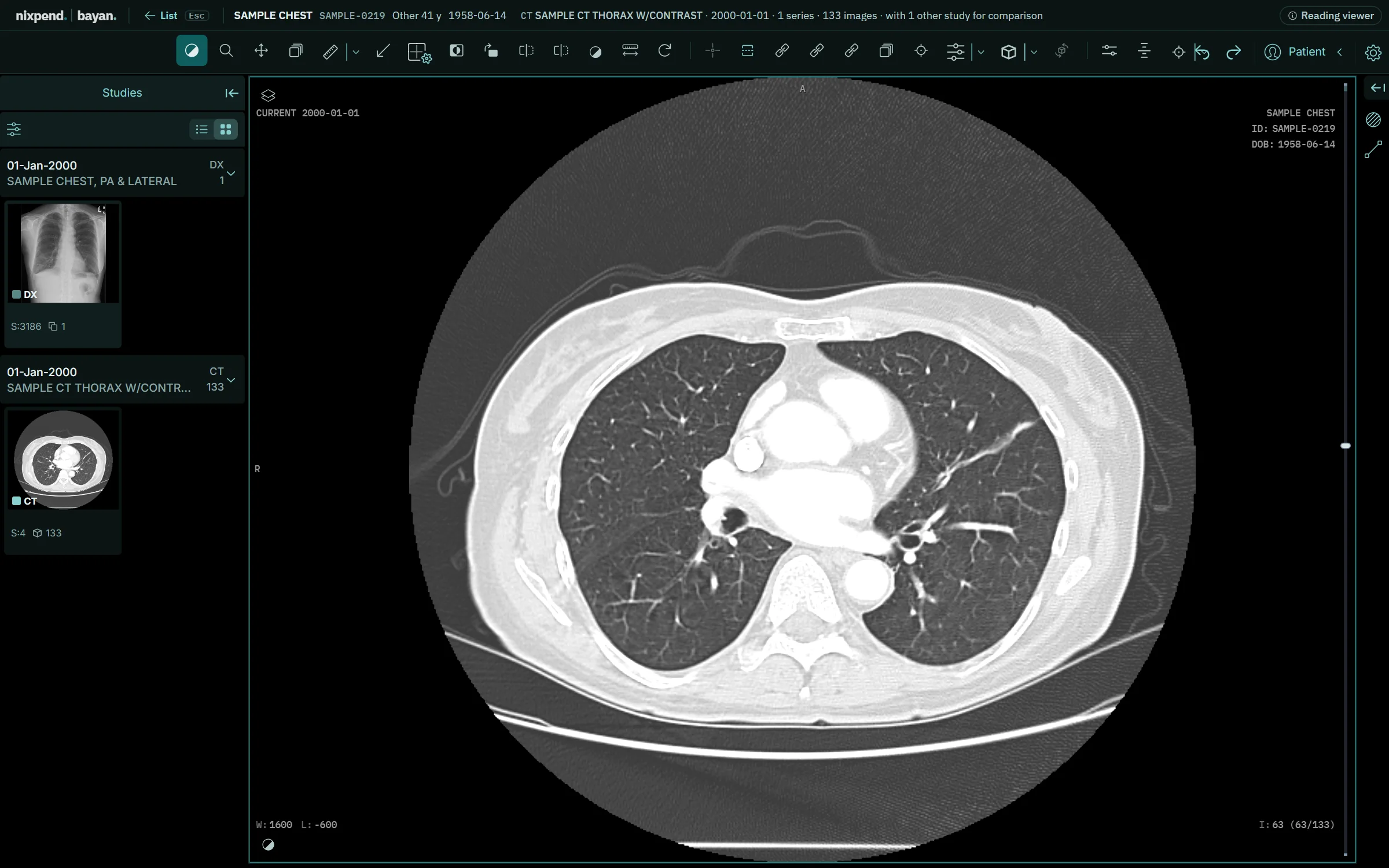 Bayan's reading viewer showing a chest CT, with the patient's studies listed beside it.
